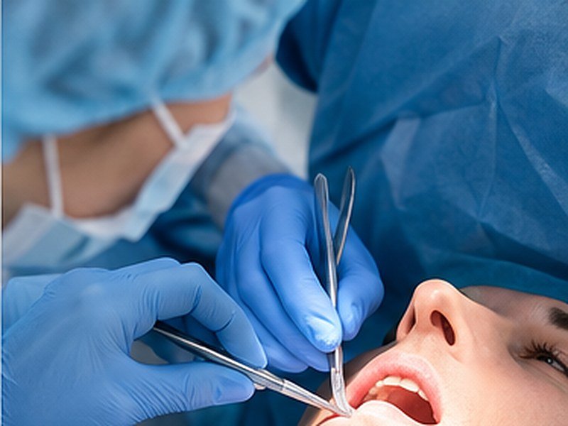 Oral surgery