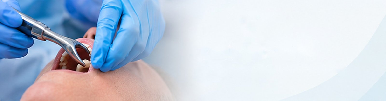 Oral surgery in Valencia | Clínica Dental Baleares