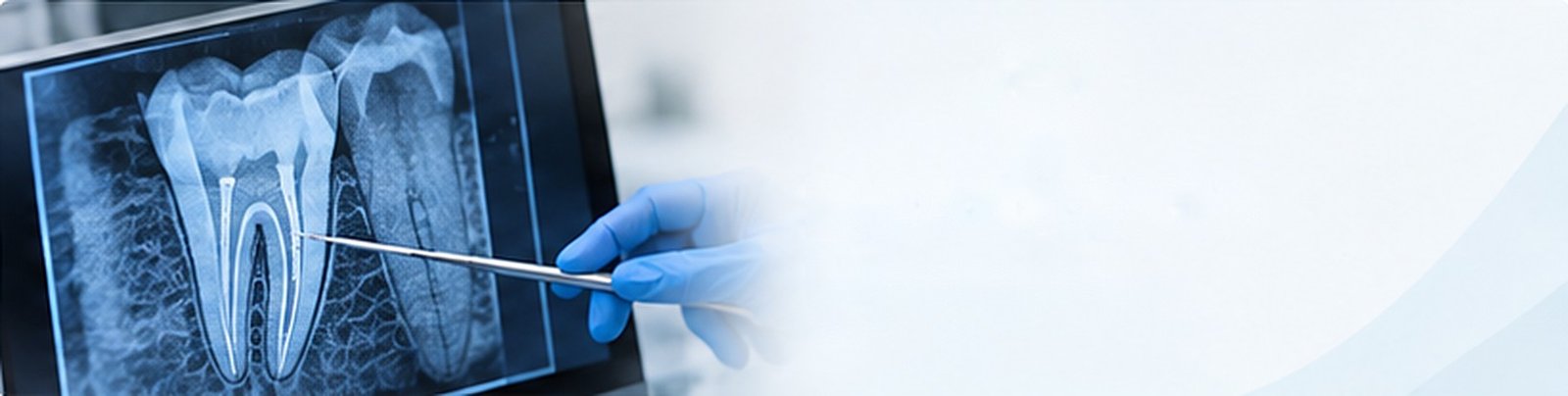 Root canal treatment (endodontics) in Valencia | Clínica Dental Baleares